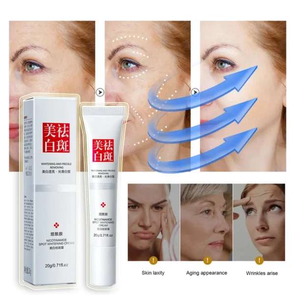 Effective Whiten Cream Face Spots Remove Dark Spot Melasma Pigmentation Improve Dullness Face Skin Care Cream Beauty Health - Image 3
